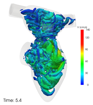 Numerical simulation of blood flow in the heart (courtesy of Prof. Alfio Quarteroni)